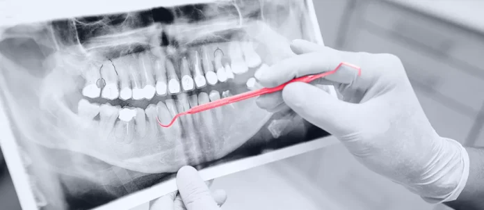 Machine learning algorithms used in dentistry