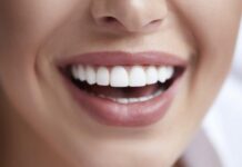 The Blueprint for a Perfect Smile: A Comprehensive Guide to Dental Implants in Dallas