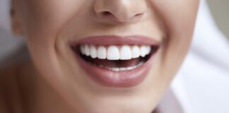 The Blueprint for a Perfect Smile: A Comprehensive Guide to Dental Implants in Dallas